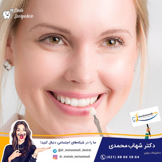 بهترین طبقه بندی کامپوزیت برای ونیر دندان کدام است؟ - کلینیک دندانپزشکی دکتر شهاب محمدی